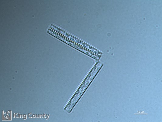 Photo of Thalassionema nitzschioides